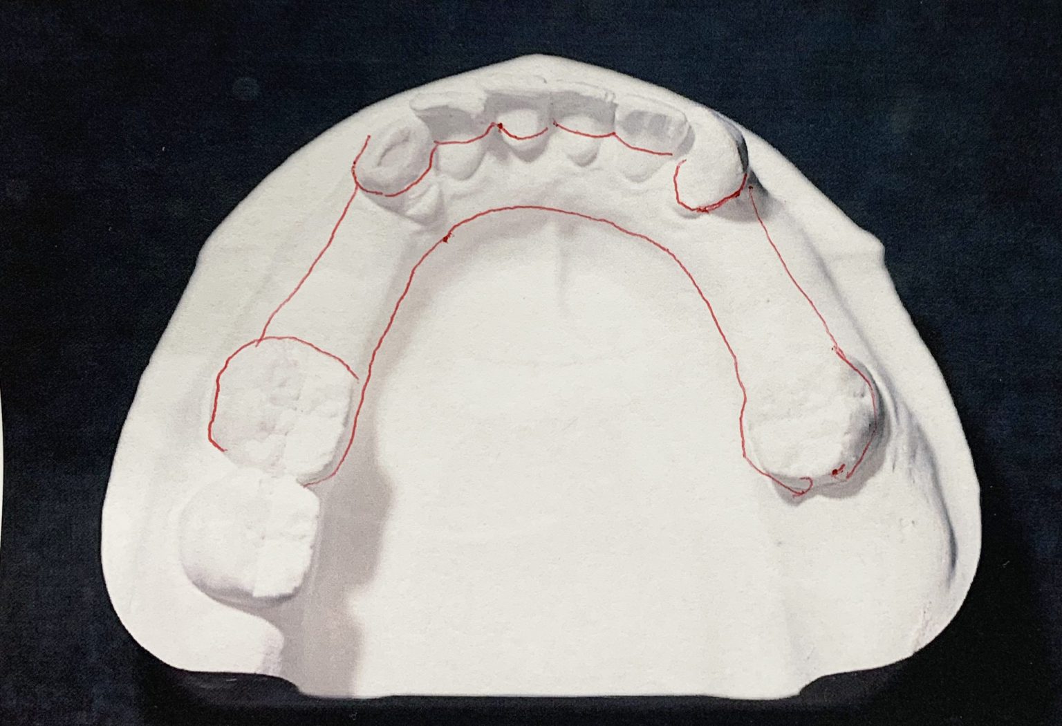 Understanding Design 3 TCS Dental Inc